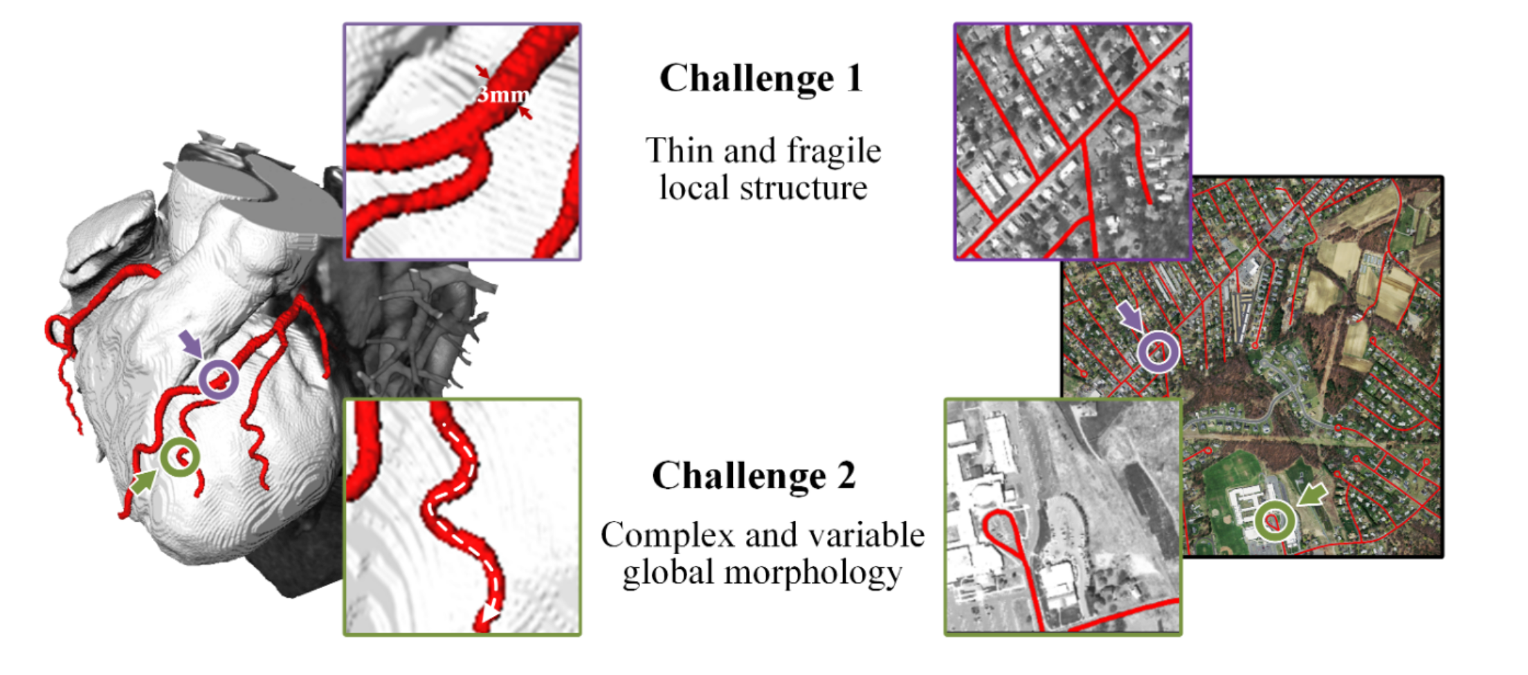 Examples of tubular structures